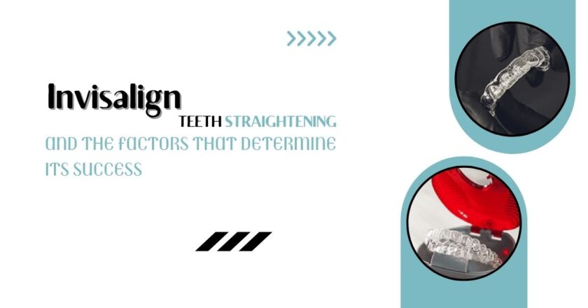 Invisalign teeth straightening and the factors that determine its success